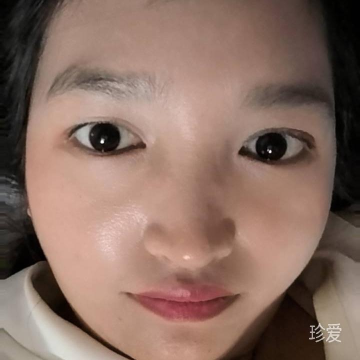 LiNG小瓶蓋兒