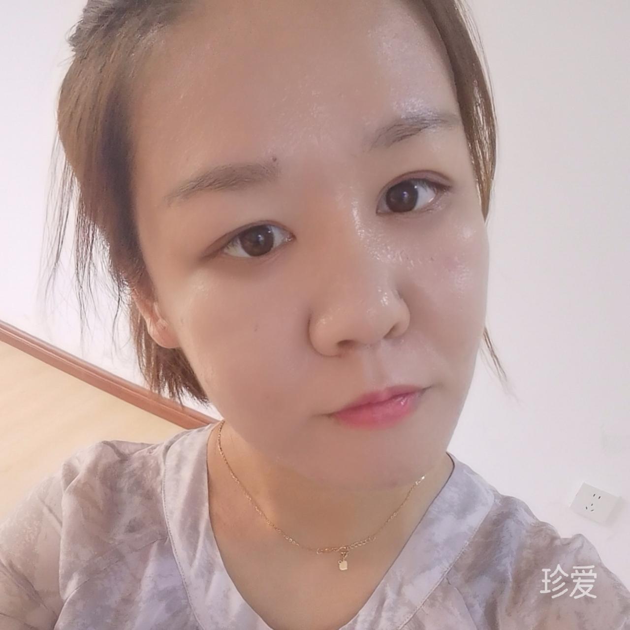阳光微微笑