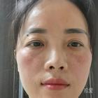 劫后余生