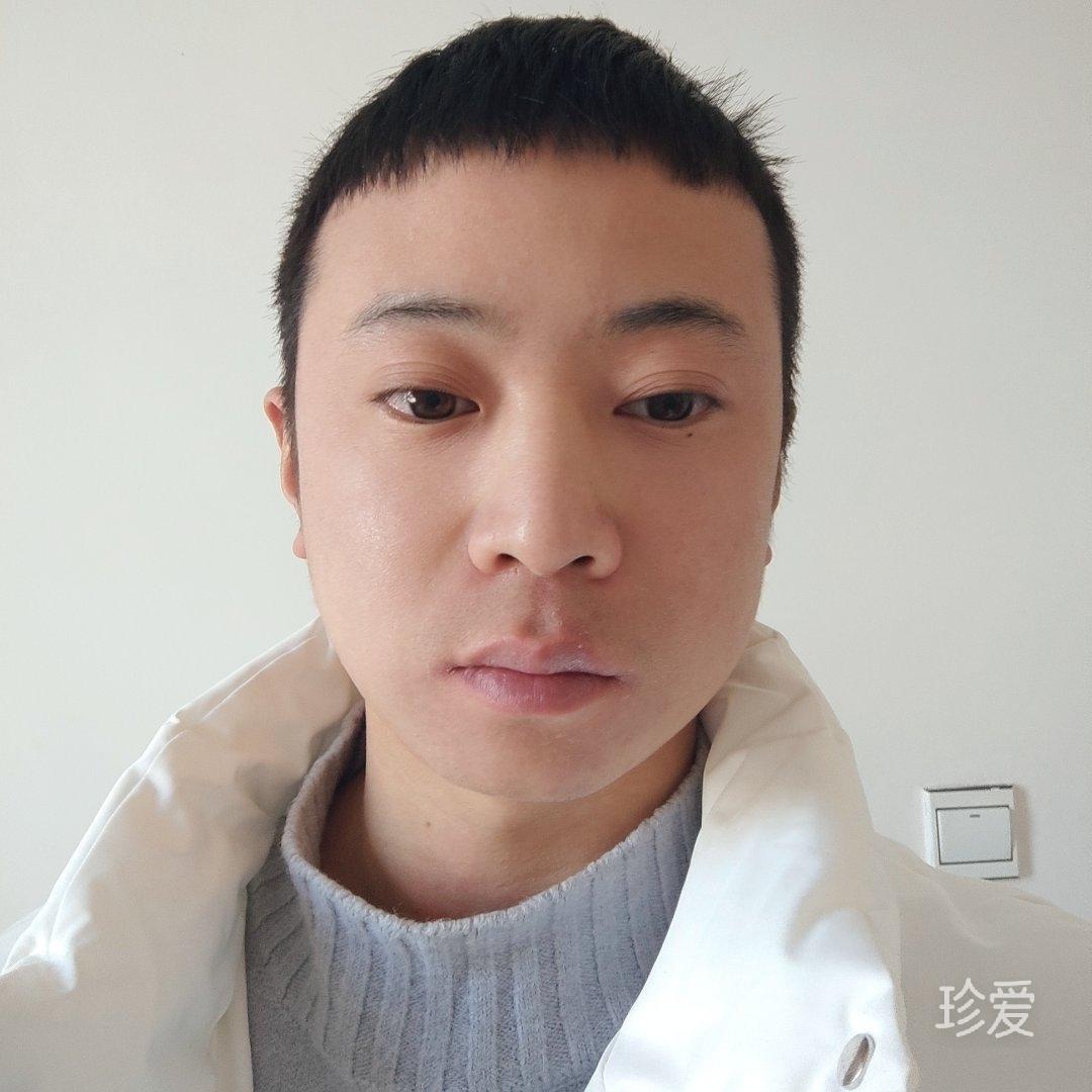 呆呆