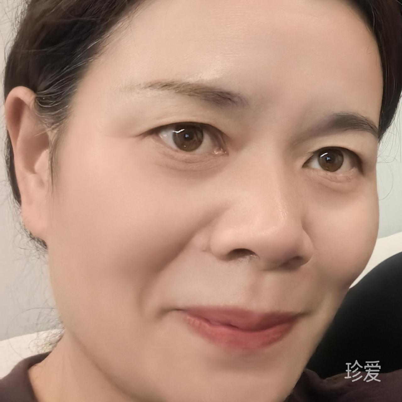 晨晨