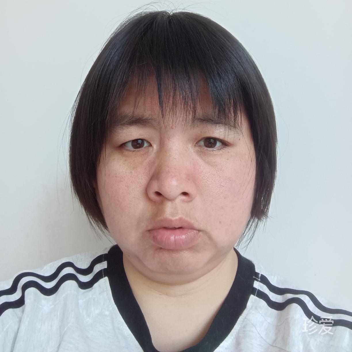 夏日的暖阳