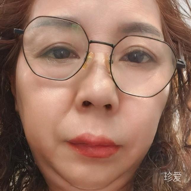 心凝