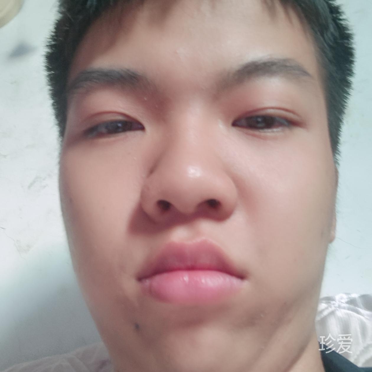 aibu