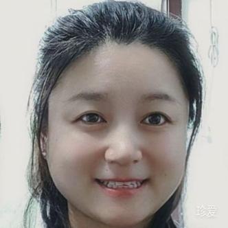 影子背后的故事