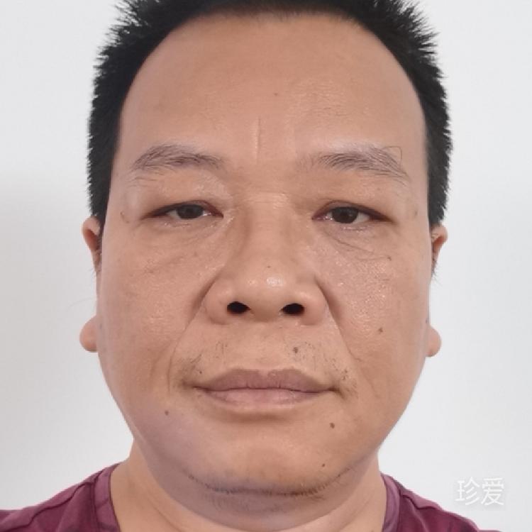 黎明前的黑暗qi35