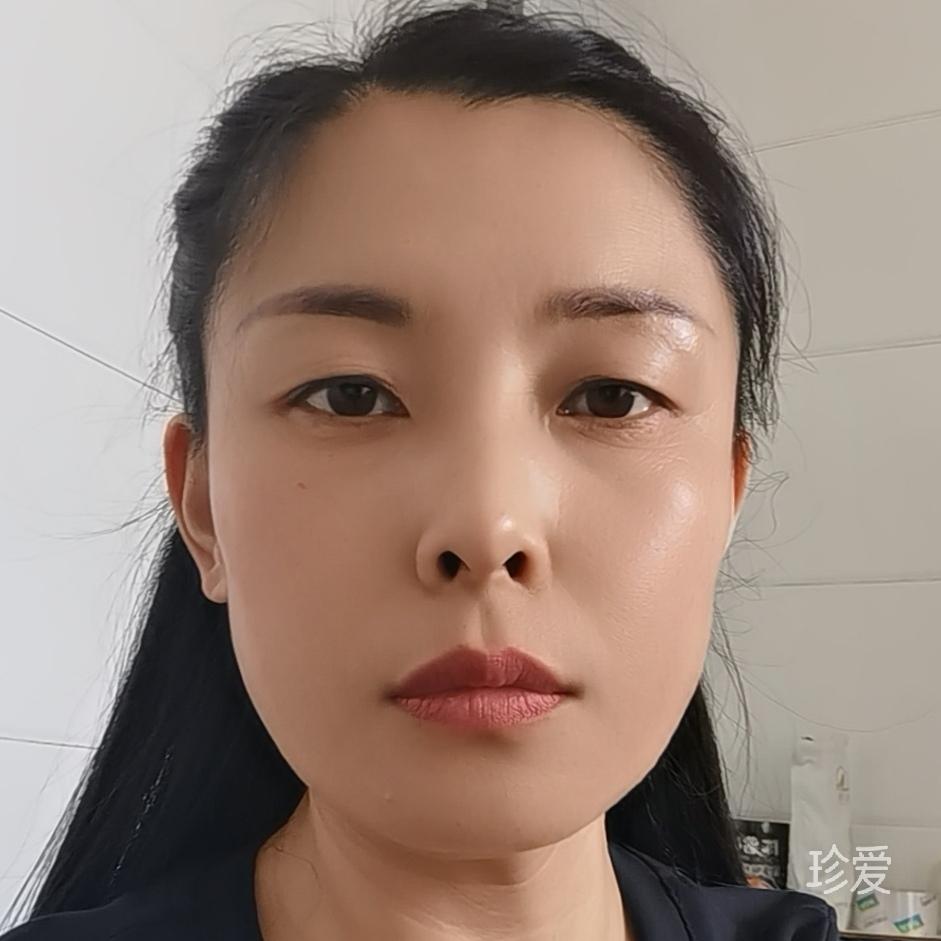 皓辉