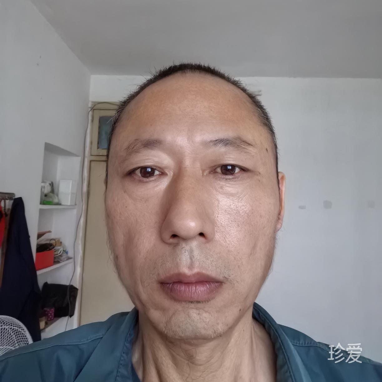 达明