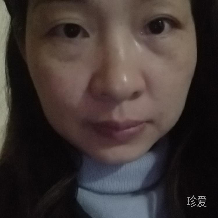 雪芷