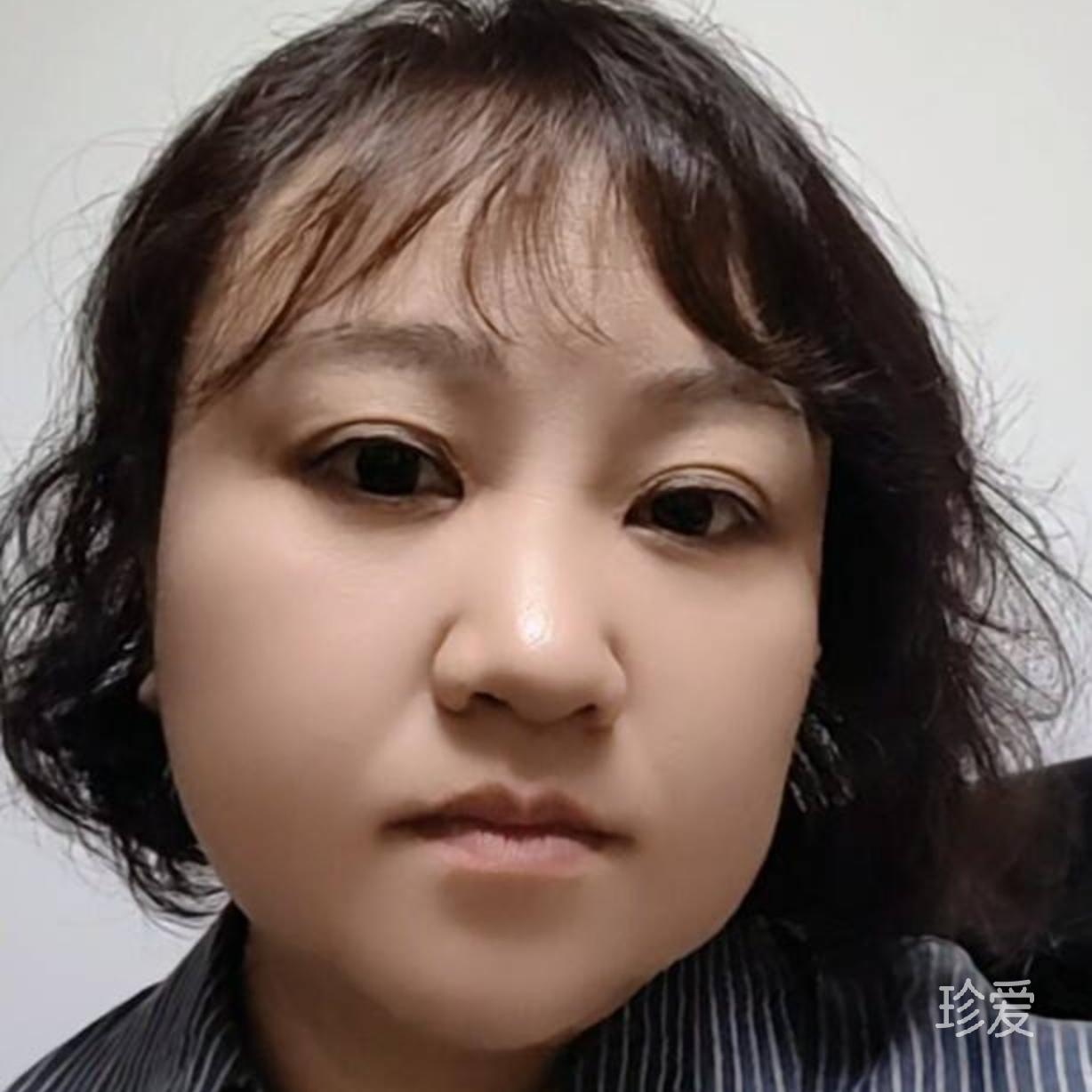 啊飞