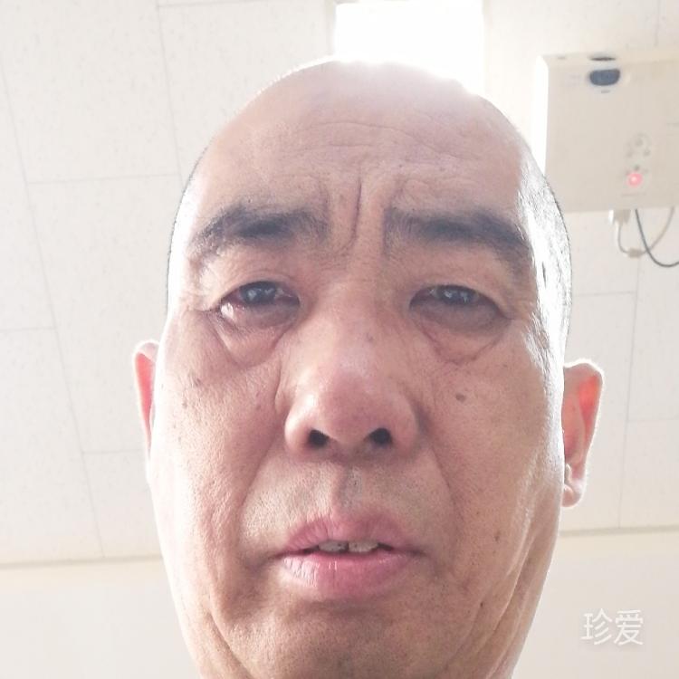 眼里风景