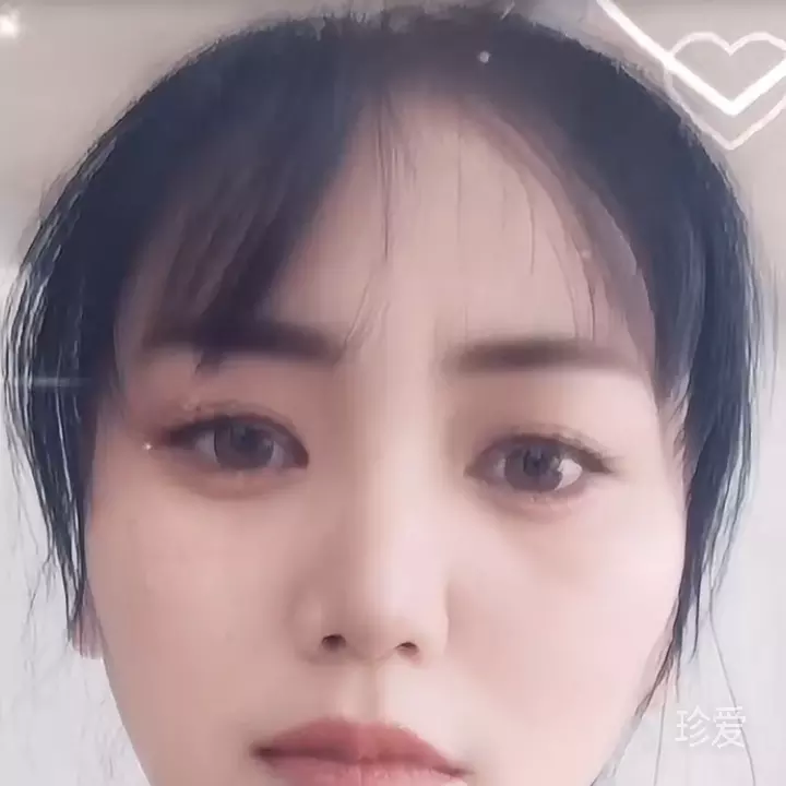 琼琼