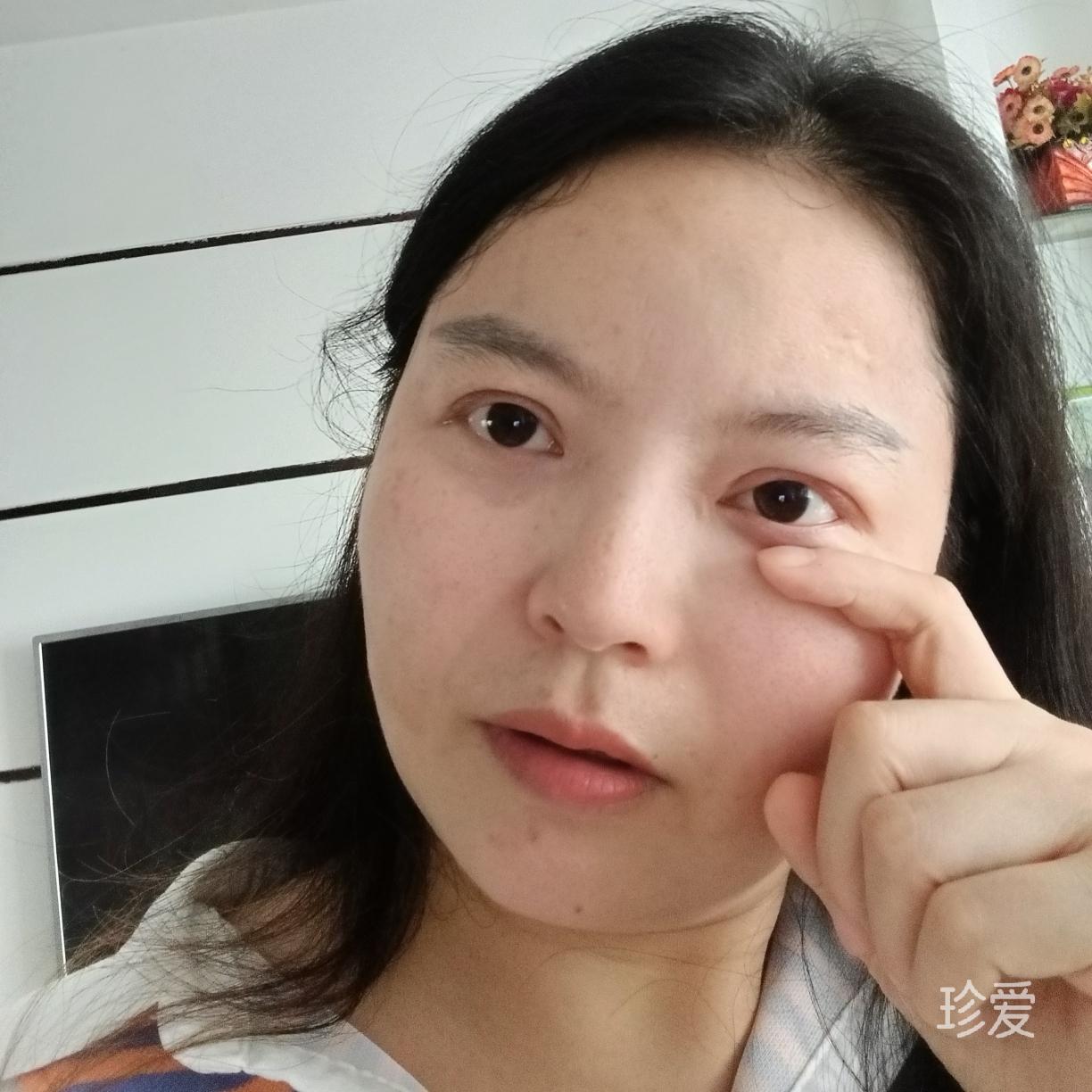 桂花树桂胆胆