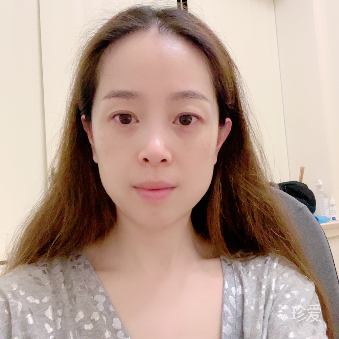 晴天的的一朵云