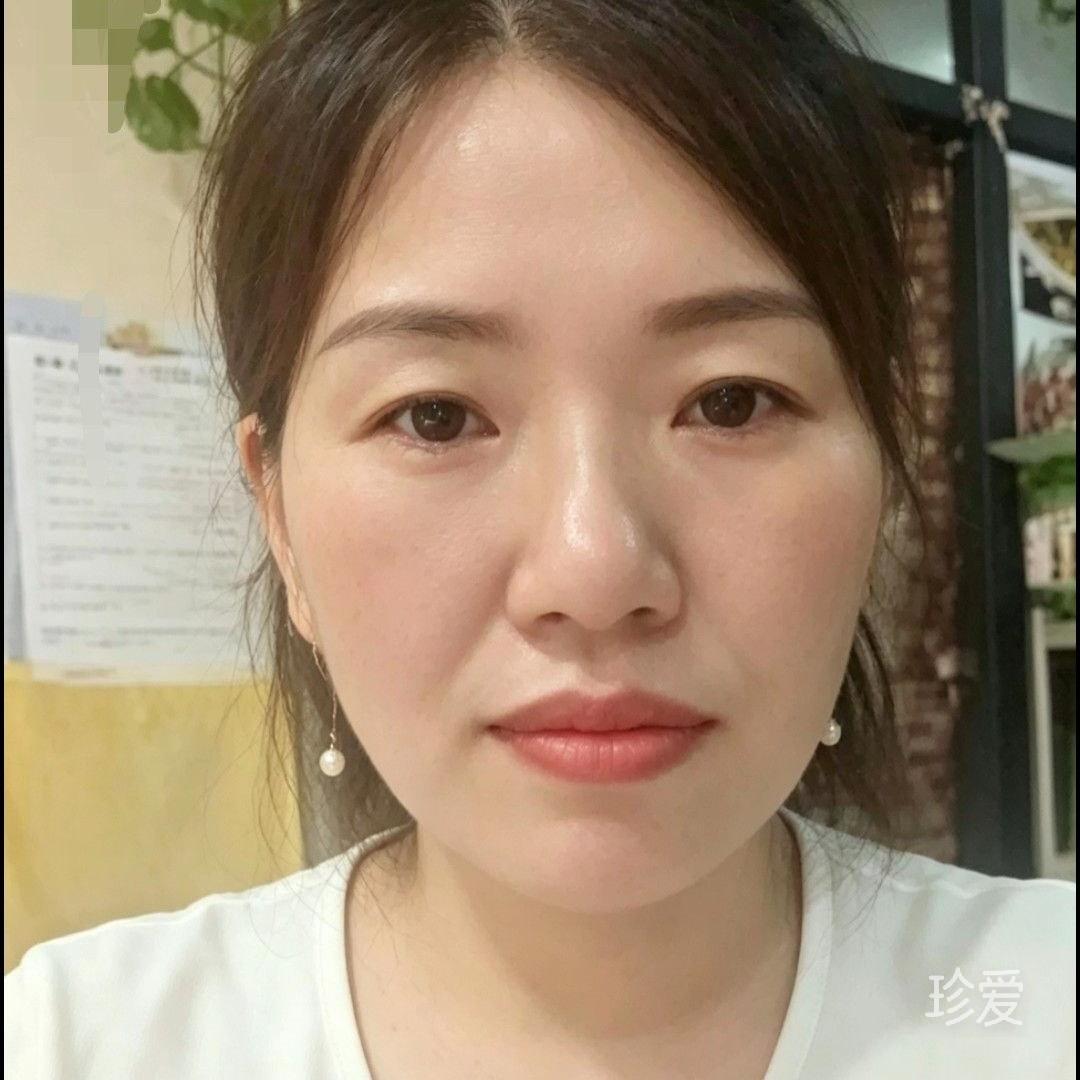 小烟