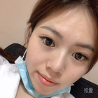 安妮