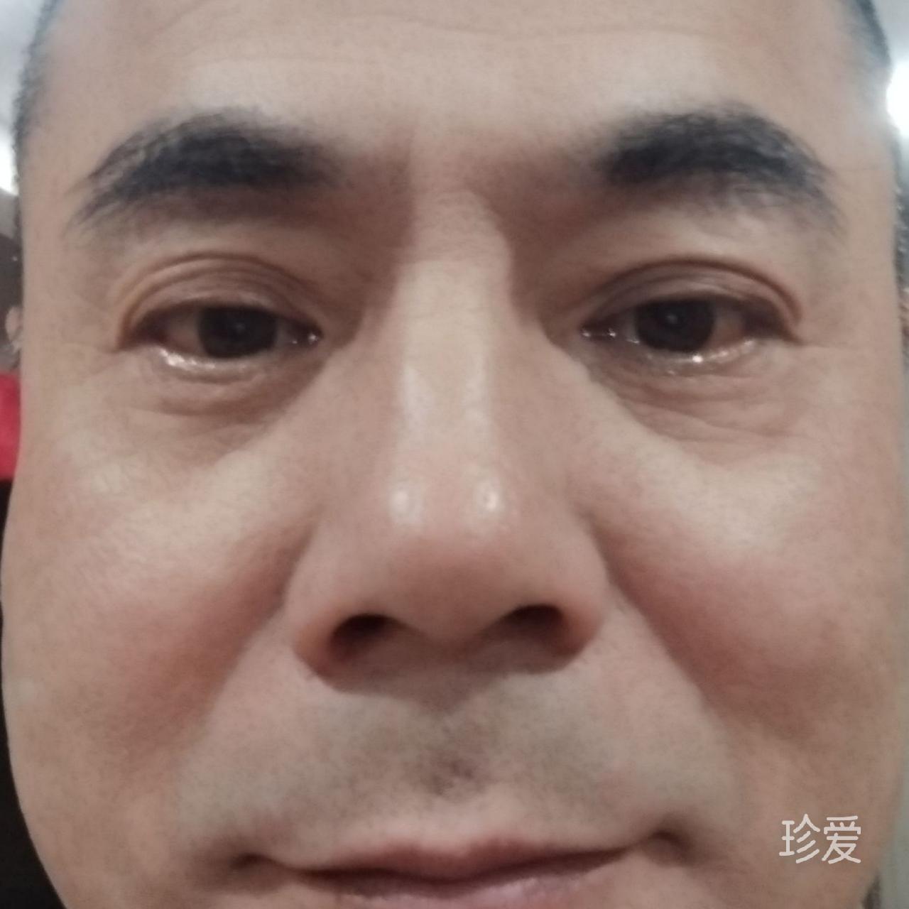 姚慧明