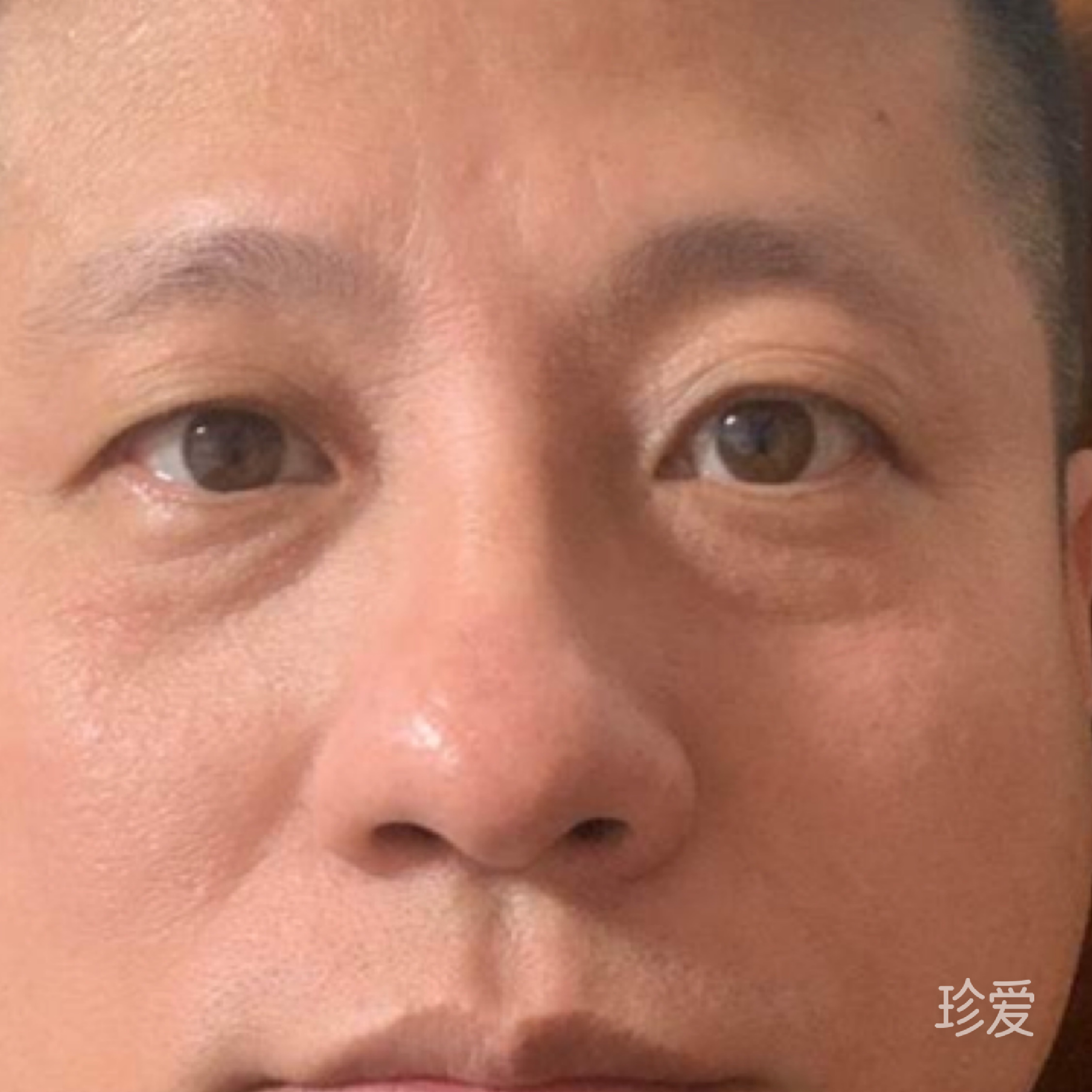 后知后觉