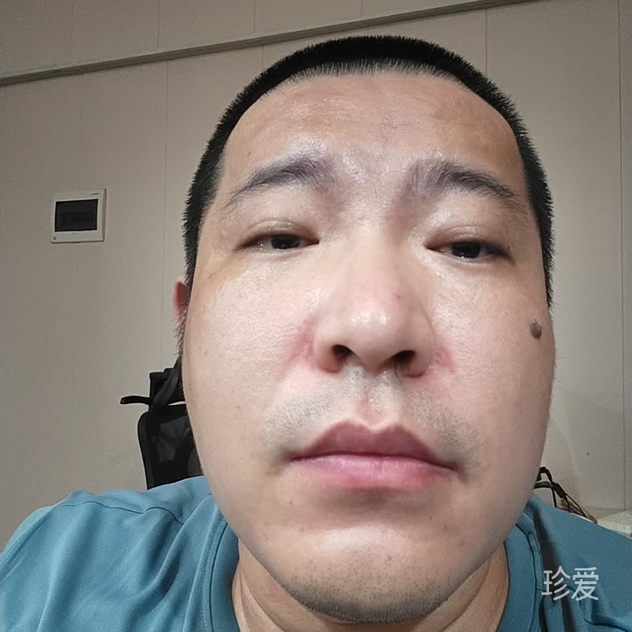 张普通