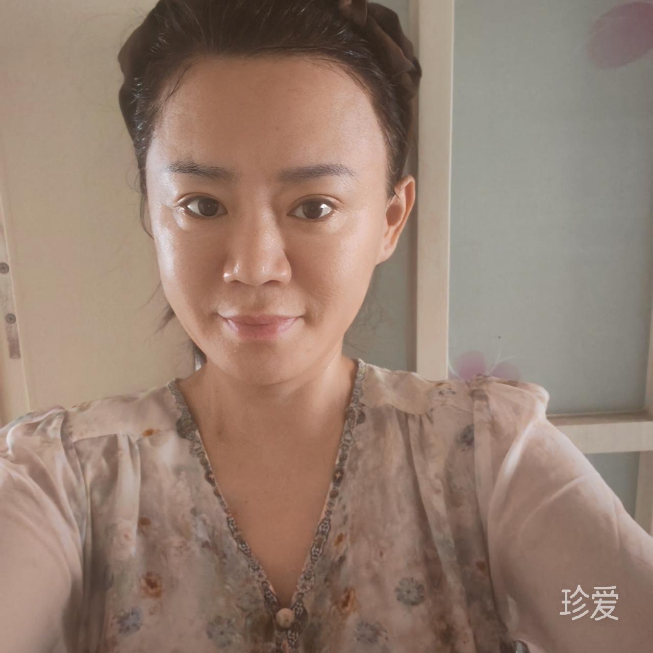 玖玖