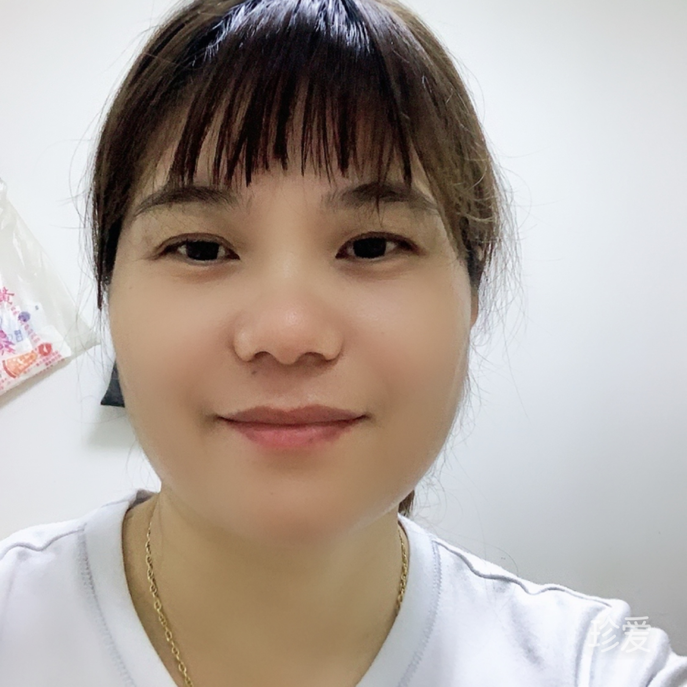 阳光刺穿心脉