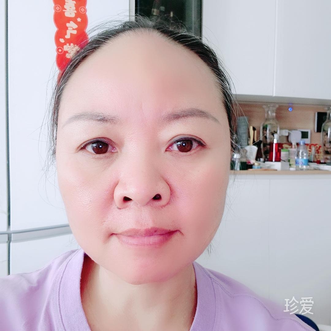 拂晓的阳光