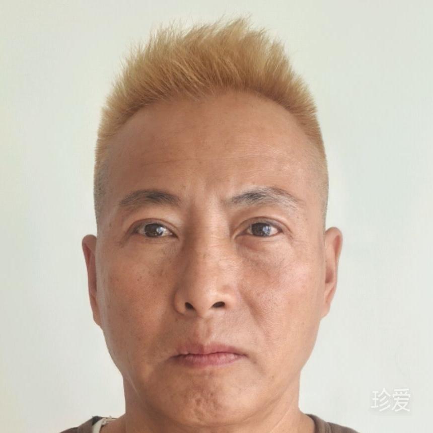 宽宏大度