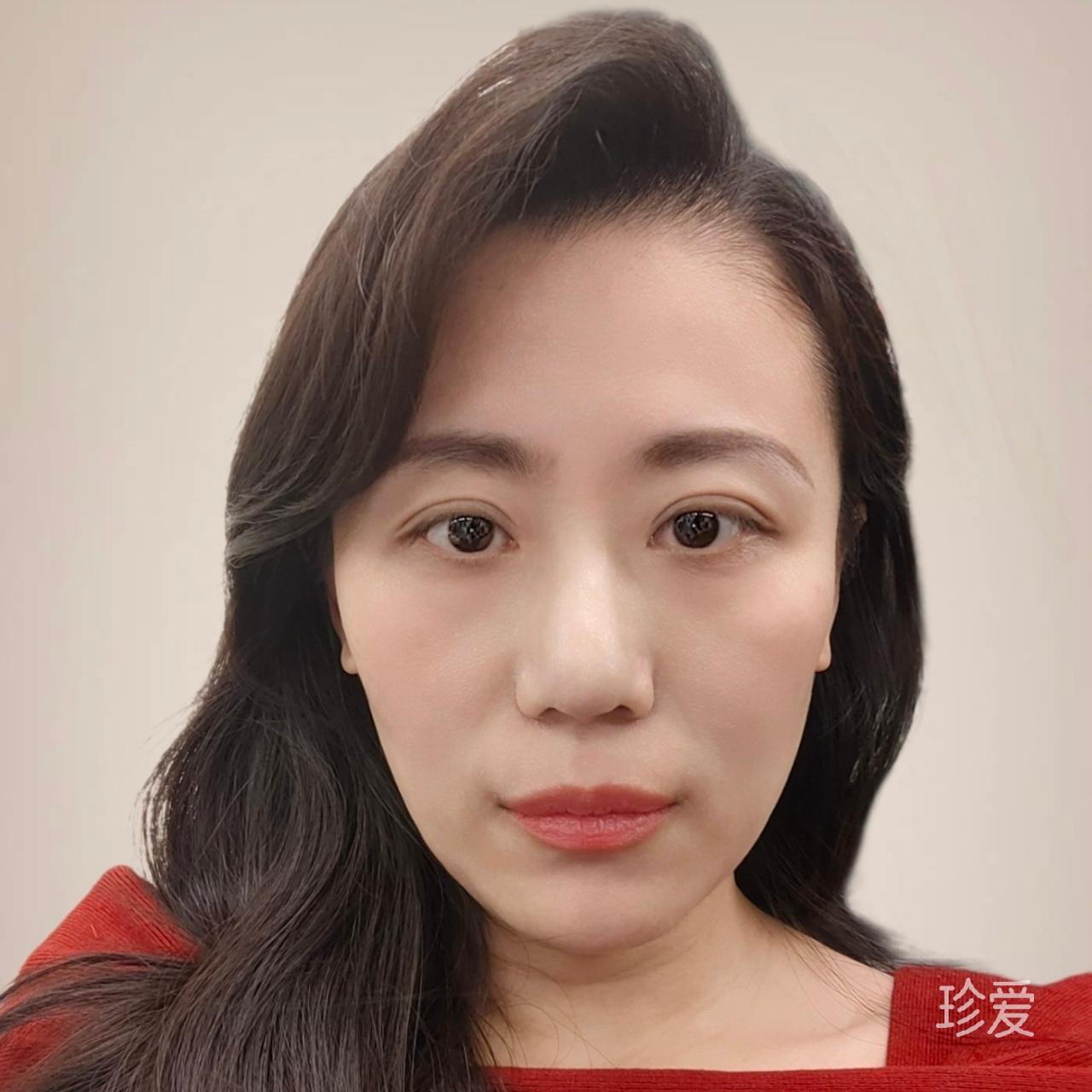 蓥