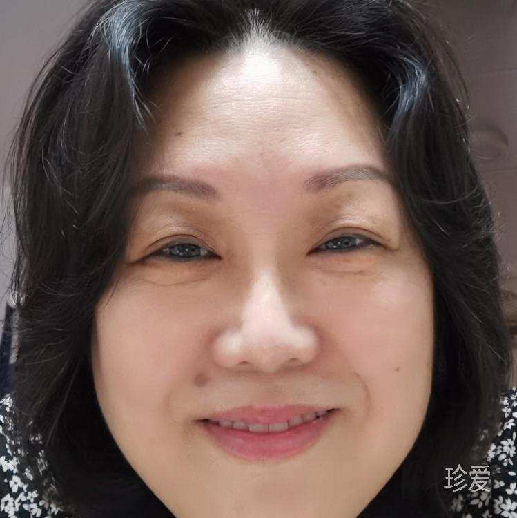 浅浅