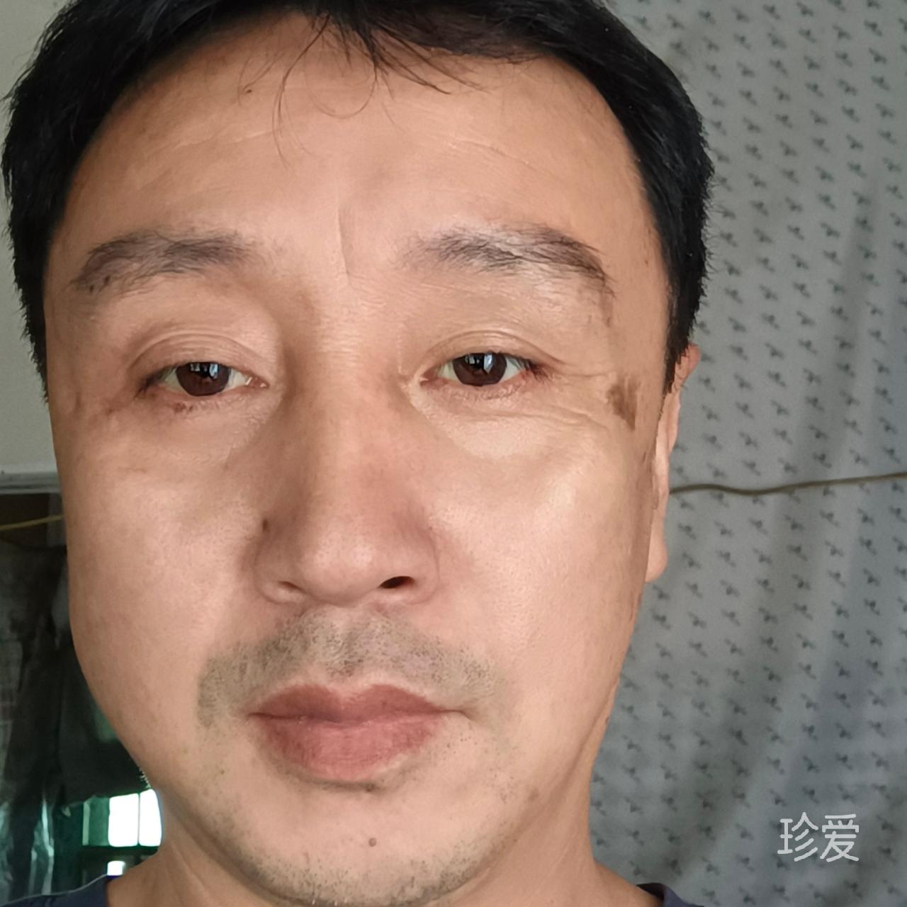 雨后阳光灿烂辉煌