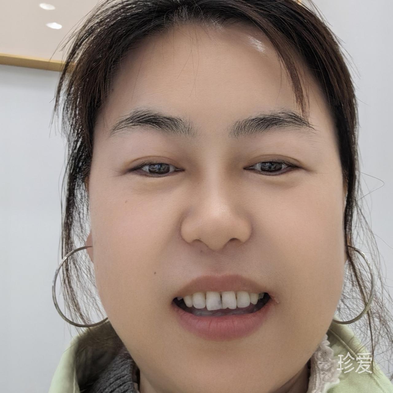 格格
