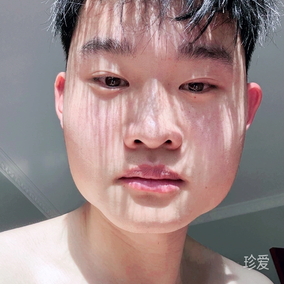 雨天后的你