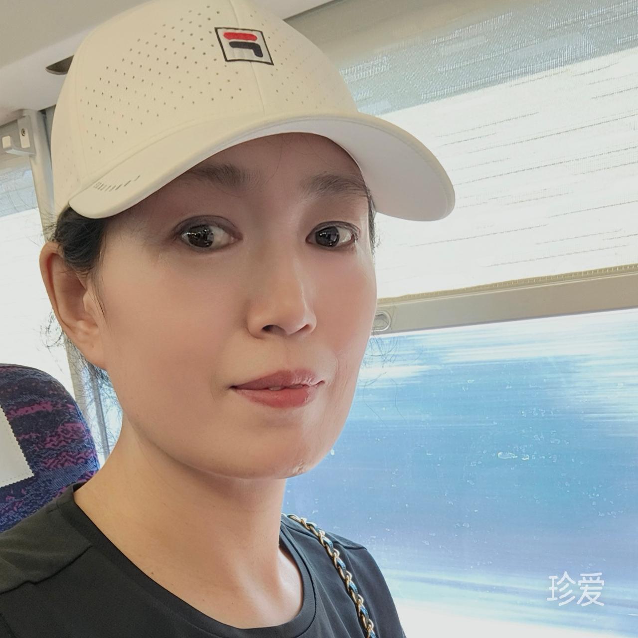 小松籽儿