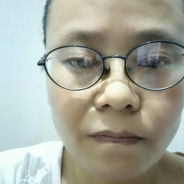 刺猬向往外面的天空