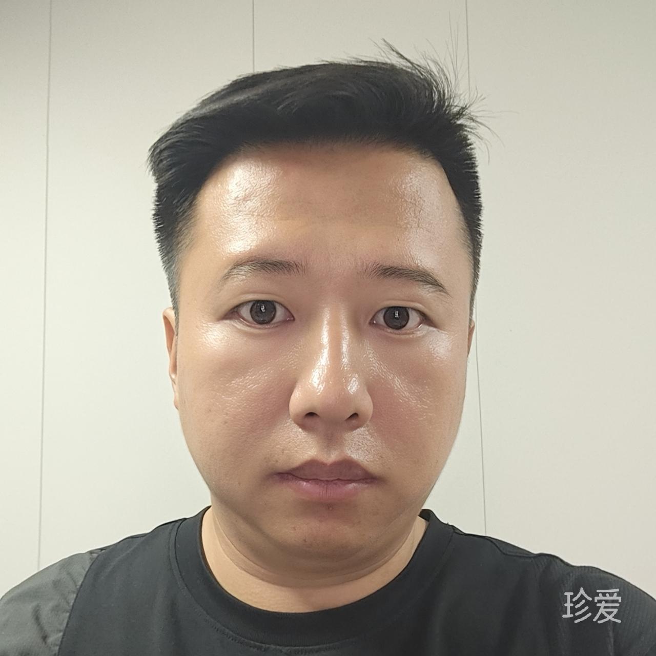 芋头