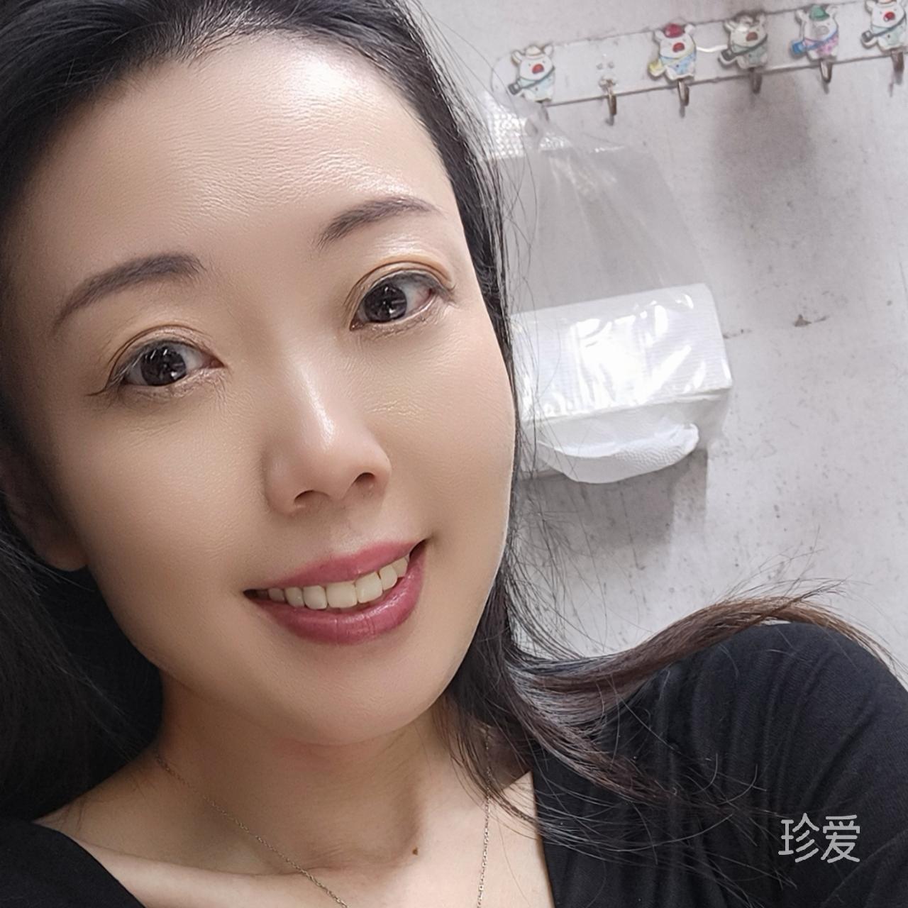 倪妮