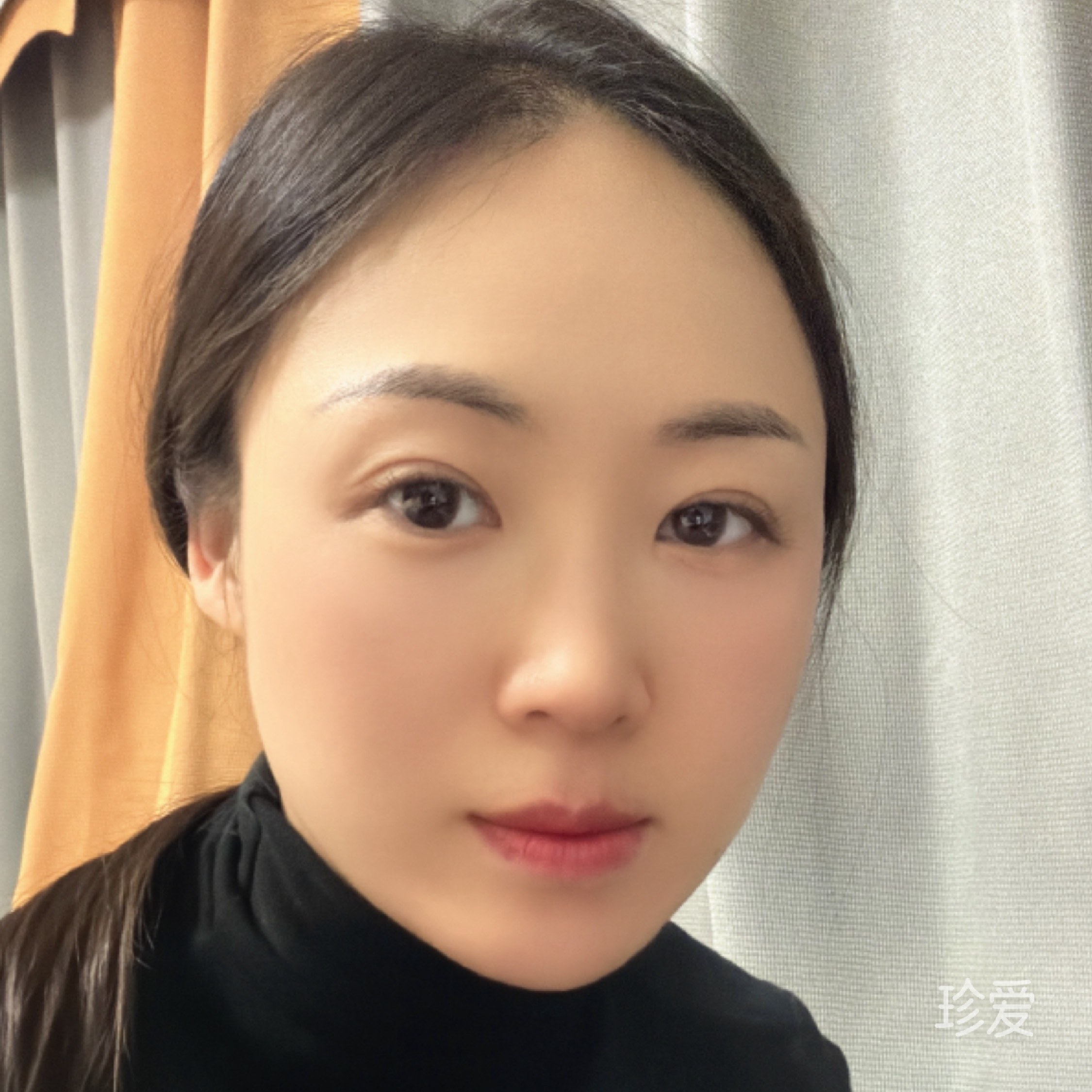 向阳