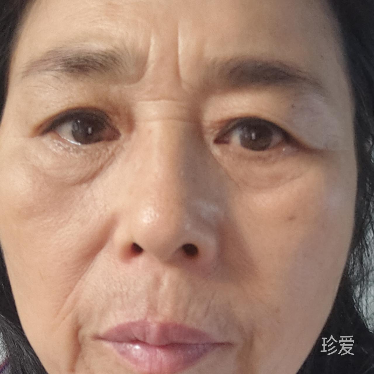 盛夏的蓝绣球