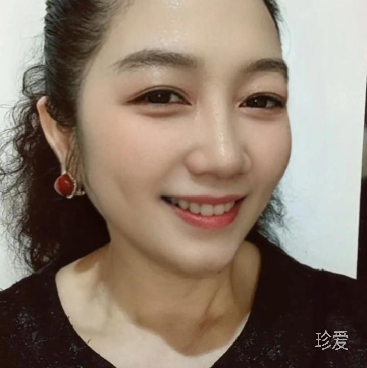 默