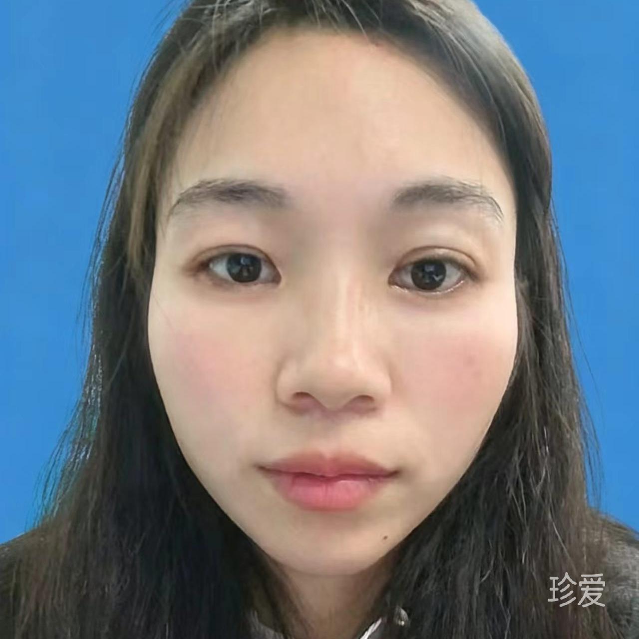 亮点