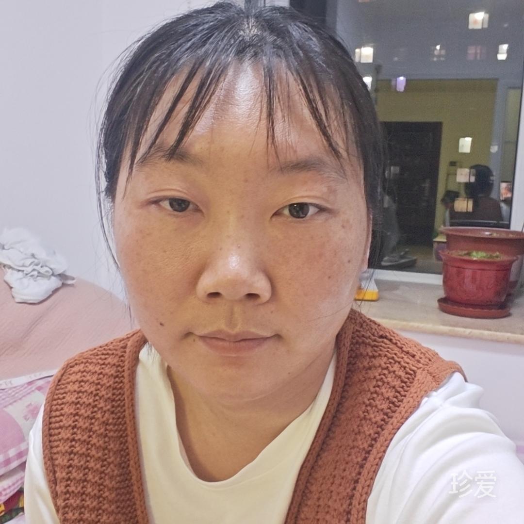 雷琪