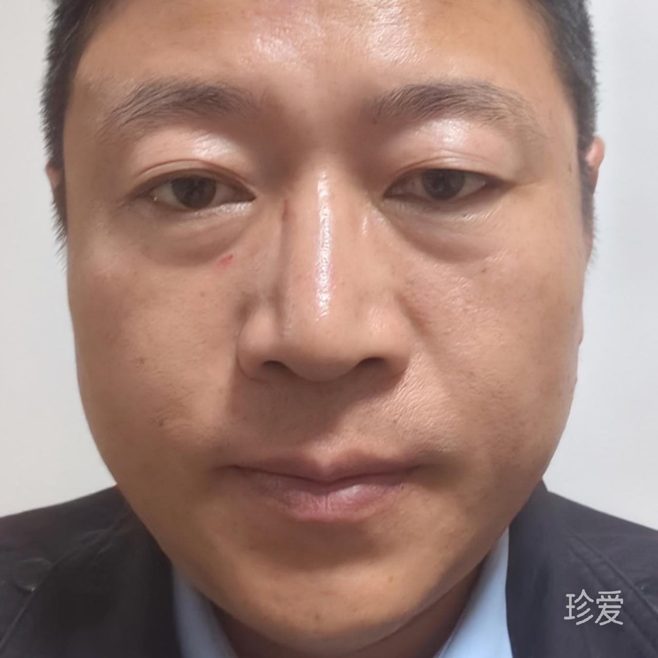 坐在一旁观世界