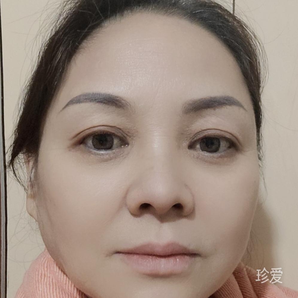 安琪拉