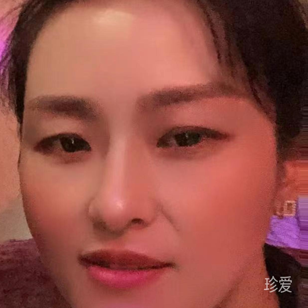 暖阳