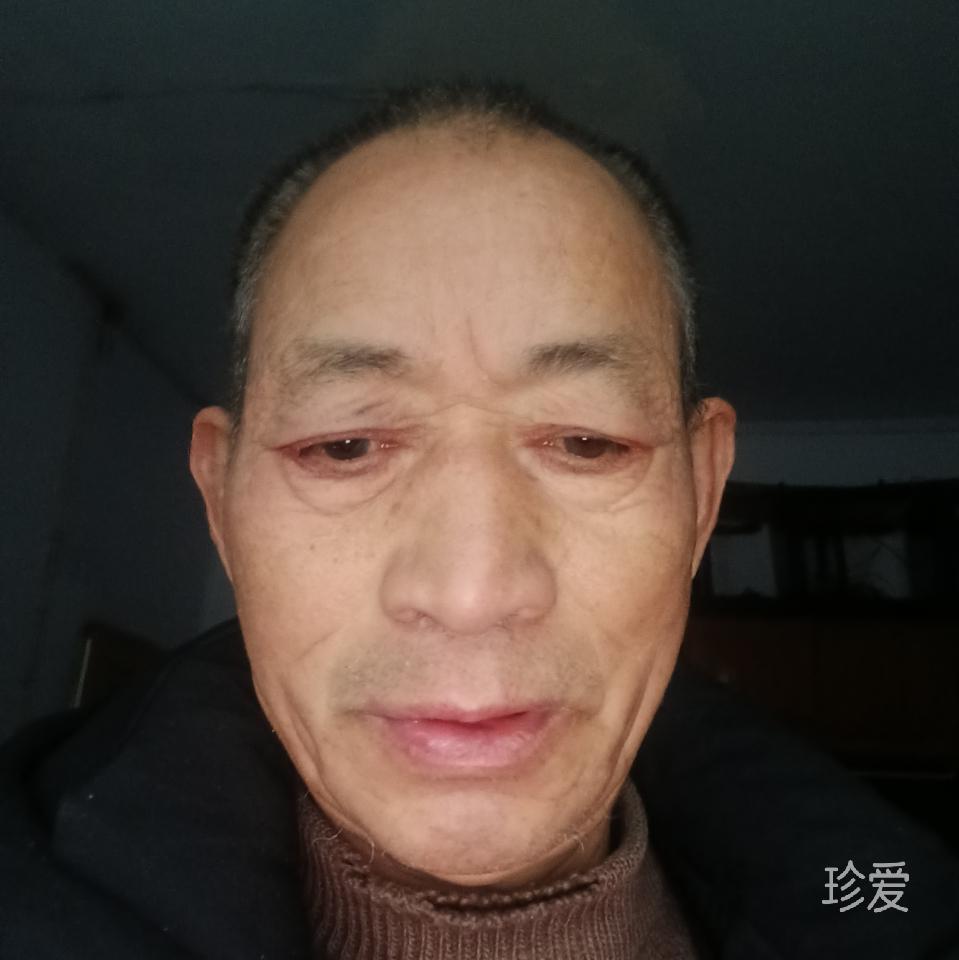 张哥