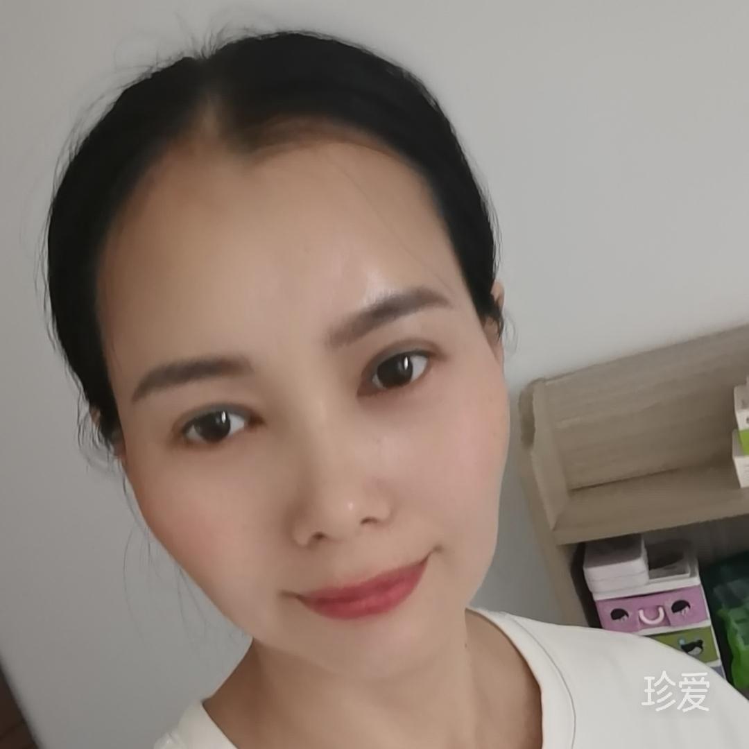 阳光
