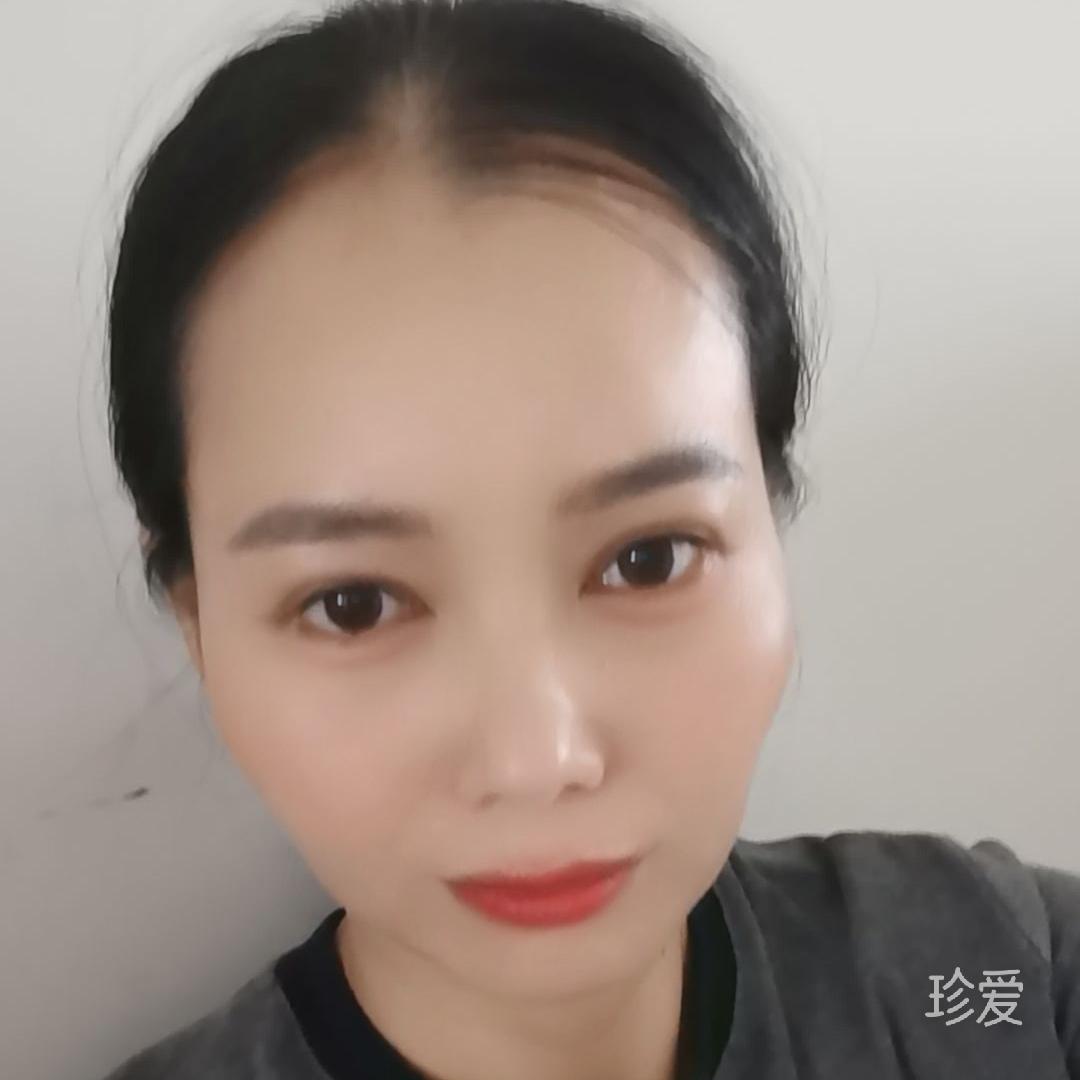阳光