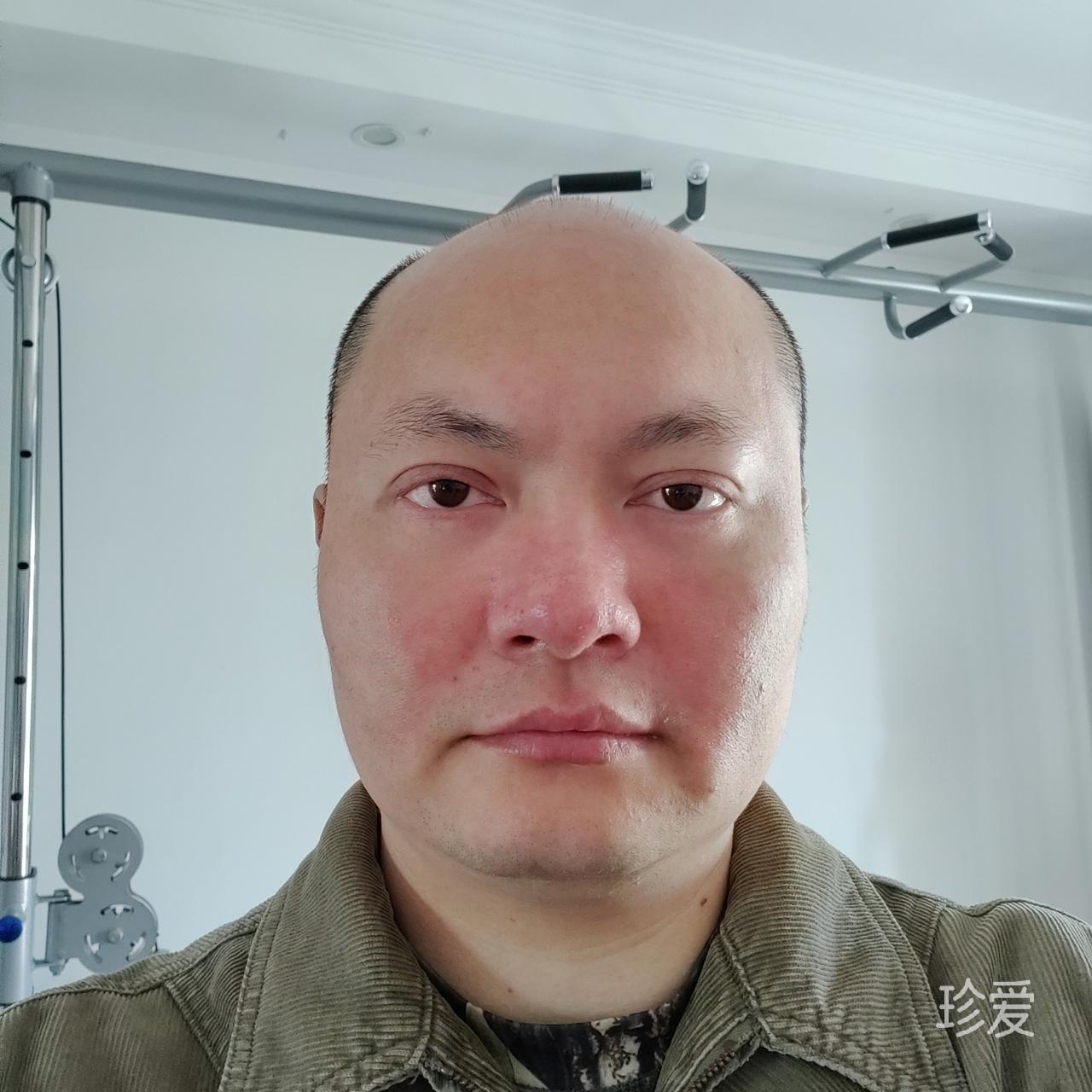 逆火