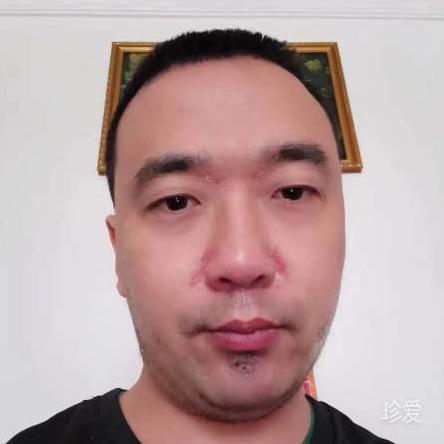 艾尔温巴德