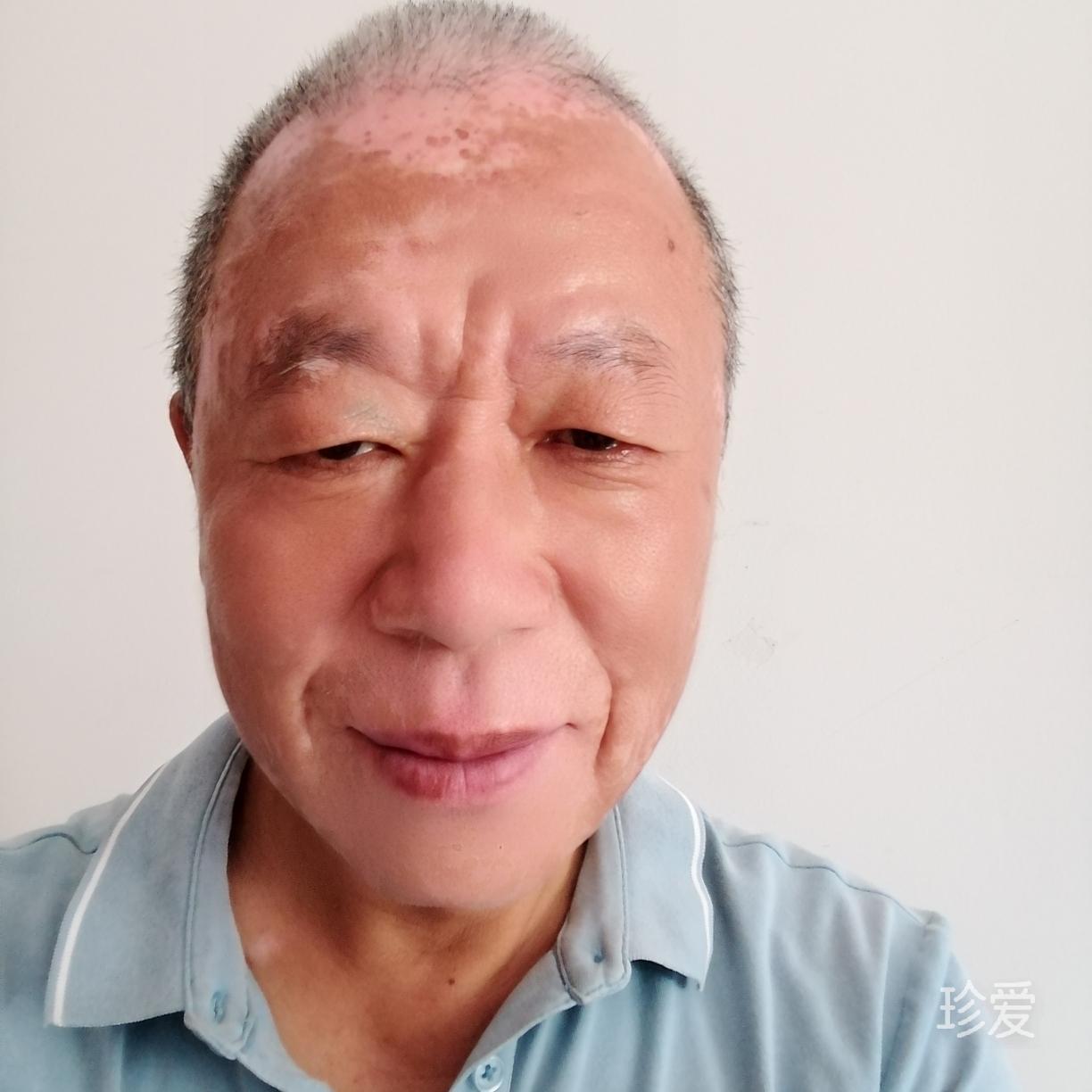 等待那道光线